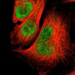 Sirtuin 1/SIRT1 Antibody, Novus Biologicals 0.1mL; Unlabeled:Antibodies,